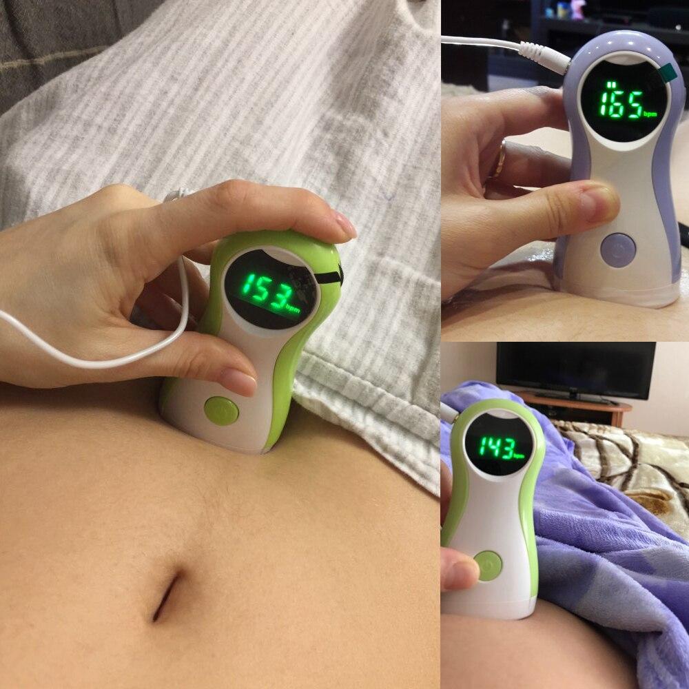 MEDICAL FETAL DOPPLER